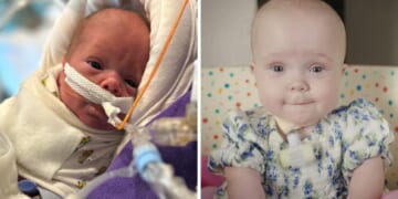 26-Week-Premature Baby Heads Home From the Hospital