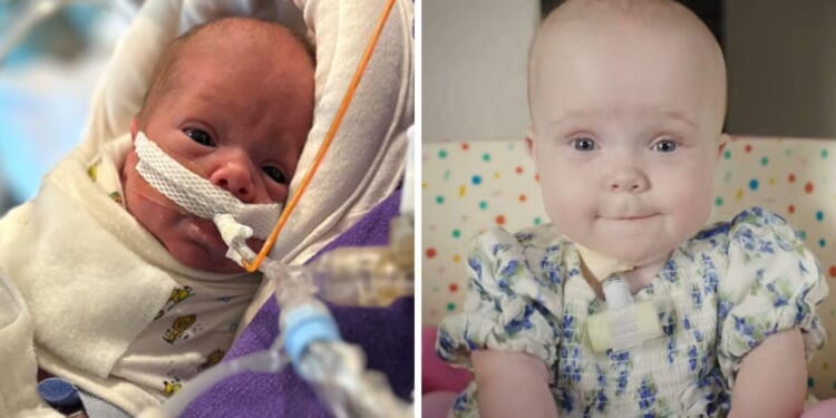 26-Week-Premature Baby Heads Home From the Hospital