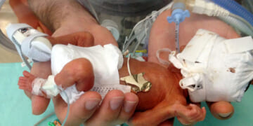 Baby Born Alive at 23 Weeks After Surviving Forced Abortion