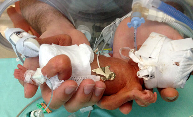 Baby Born Alive at 23 Weeks After Surviving Forced Abortion