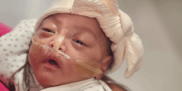 Baby Girl Born at 22 Weeks Sets a Record and Defies the Odds