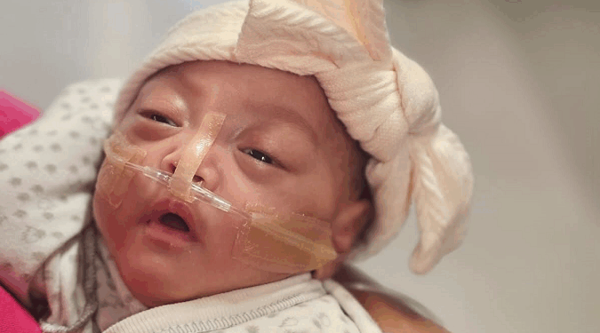Baby Girl Born at 22 Weeks Sets a Record and Defies the Odds