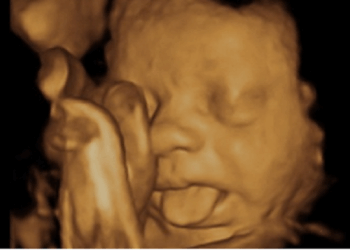 No Matter What They Call It, Abortion Kills Babies