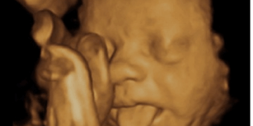 No Matter What They Call It, Abortion Kills Babies