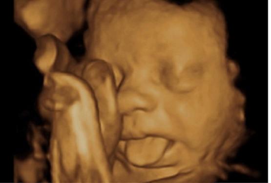 No Matter What They Call It, Abortion Kills Babies
