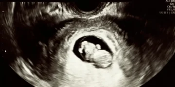 Pregnant Mom Rejected Abortion After Seeing Ultrasound of Her Baby