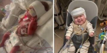 Premature Baby Who Only Weighed 24 Ounces Heads Home From Hospital