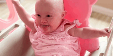 Support for Children With Down Syndrome Surges After Influences End Their Baby's Life