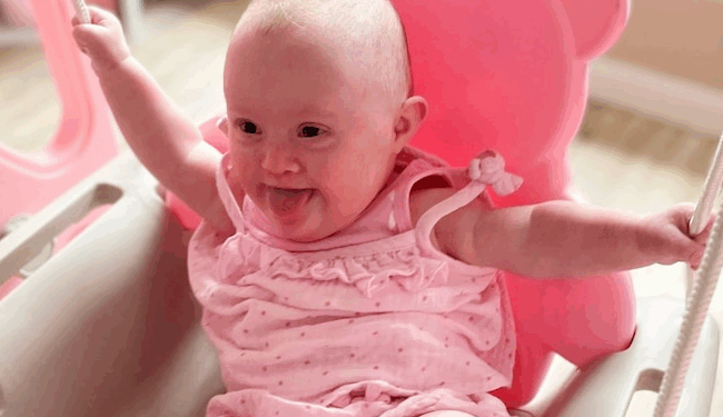 Support for Children With Down Syndrome Surges After Influences End Their Baby's Life