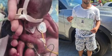 Tiny Premature Baby Born at 26 Weeks is Now a Thriving 23-Year-Old