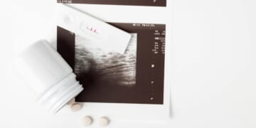 Abortion count rises as women turn to chemical abortions, per new data