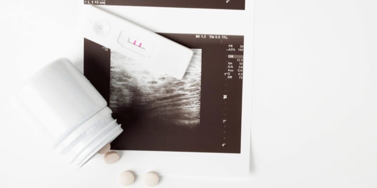 Abortion count rises as women turn to chemical abortions, per new data