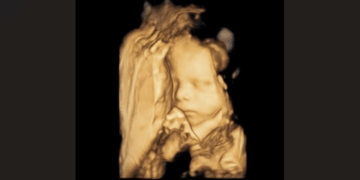 Baby Survives Abortion, Pro-Life Center Helps Mom After Abortion Pill Fails