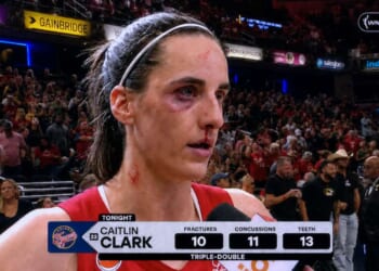 Image for article: Caitlin Clark Records Triple Double With 10 Fractures, 11 Concussions, 13 Teeth Knocked Out