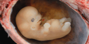 Catholic Bishops Tell Trump Admin to Not Expand IVF Over Moral Concerns