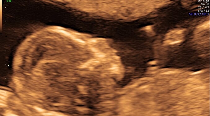 Delaware Measure for “Right” to Kill Babies in Abortions Fails
