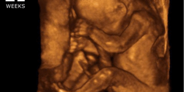 Massachusetts House Passes Bill for Abortions Up to Birth