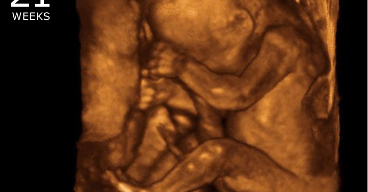 Massachusetts House Passes Bill for Abortions Up to Birth