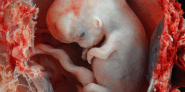 Missouri Heads to State Supreme Court to Defend Pro-Life Laws
