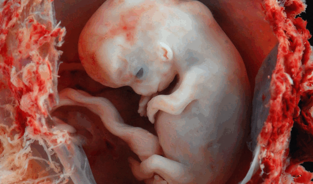 Missouri Heads to State Supreme Court to Defend Pro-Life Laws