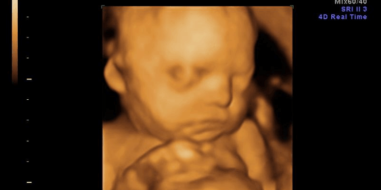 South Dakota Judge Blocks Ban on Advertising Abortion Pills