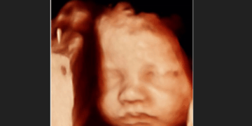 Why We Still Need to Fight Abortion Four Years After Dobbs