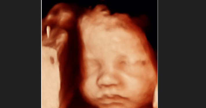 Why We Still Need to Fight Abortion Four Years After Dobbs