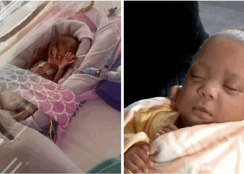 Australia’s Most Premature Baby Ever is Born at 21 Weeks 3 Days