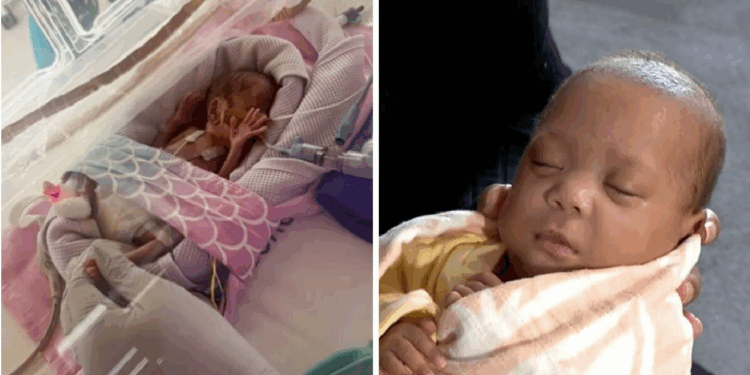Australia’s Most Premature Baby Ever is Born at 21 Weeks 3 Days