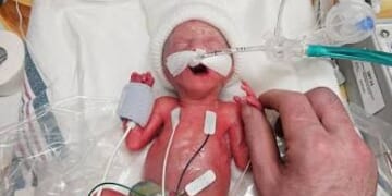 Here’s What a 24-Week Baby Looks Like, Massachusetts Just Legalized Killing Them Before Birth
