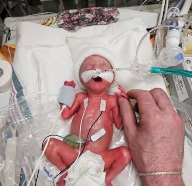 Here’s What a 24-Week Baby Looks Like, Massachusetts Just Legalized Killing Them Before Birth