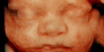 We Can’t Back Down From the Truth: Abortion Kills Babies