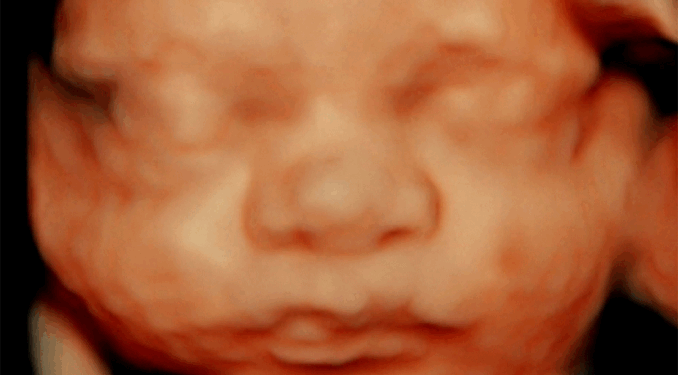 We Can’t Back Down From the Truth: Abortion Kills Babies